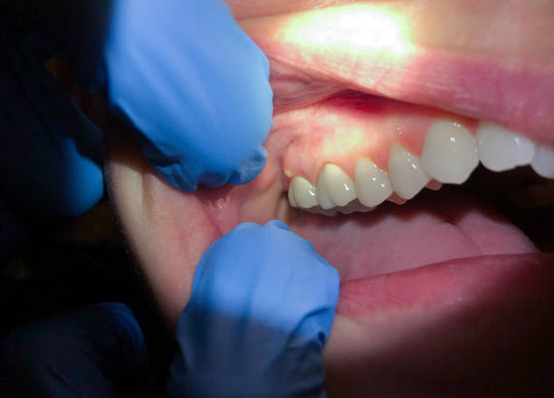 Best 24-Hour Emergency Dentist  in Holly Springs, GA